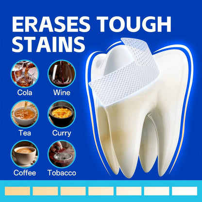 Teeth Whitening Strips – Professional Dentist Approved, Gum-Safe Formula, 28 Non-Slip Strips, 14 Treatment, Pain-Free Express Whitening Kit in 30 Min, Easy to Use for Bright Smile