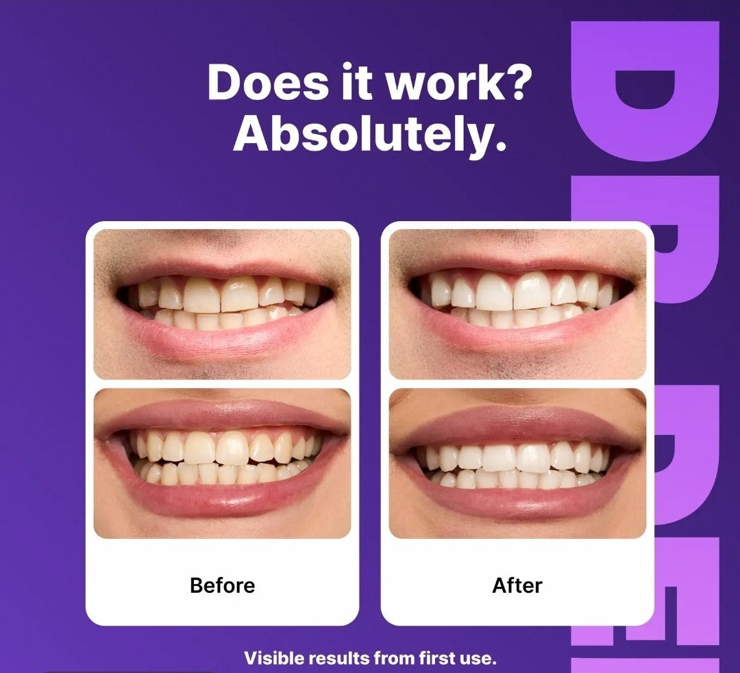 Dr Dent Professional Teeth Whitening Strips 14 Count, Safe for Enamel